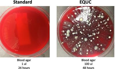 Tarnished gold—the “standard” urine culture: reassessing the characteristics of a criterion standard for detecting urinary microbes
